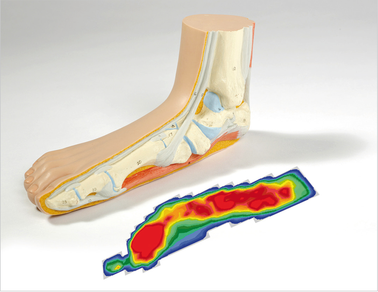 3D scan reveals how high heels can leave your feet disfigured