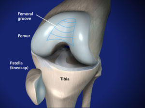 knee surgery for dislocated kneecap